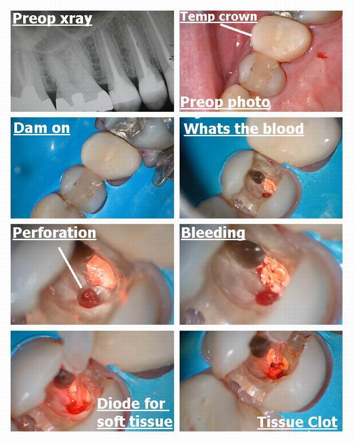 Resize of Premolar pg 1.jpg